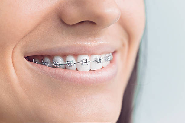 Trusted Parkville, MD  Holistic Dental Services Experts