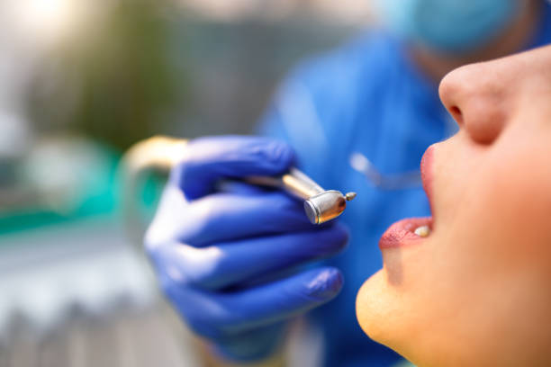 Dental Inlays and Onlays in Parkville, MD